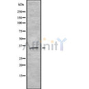 DF8701 staining HepG2 by IF/ICC. The sample were fixed with PFA and permeabilized in 0.1% Triton X-100,then blocked in 10% serum for 45 minutes at 25¡ãC. The primary antibody was diluted at 1/200 and incubated with the sample for 1 hour at 37¡ãC. An  Alexa Fluor 594 conjugated goat anti-rabbit IgG (H+L) Ab, diluted at 1/600, was used as the secondary antibod
