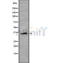 DF8702 staining RAW264.7 by IF/ICC. The sample were fixed with PFA and permeabilized in 0.1% Triton X-100,then blocked in 10% serum for 45 minutes at 25¡ãC. The primary antibody was diluted at 1/200 and incubated with the sample for 1 hour at 37¡ãC. An  Alexa Fluor 594 conjugated goat anti-rabbit IgG (H+L) Ab, diluted at 1/600, was used as the secondary antibod