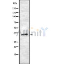 DF8704 staining Hela by IF/ICC. The sample were fixed with PFA and permeabilized in 0.1% Triton X-100,then blocked in 10% serum for 45 minutes at 25¡ãC. The primary antibody was diluted at 1/200 and incubated with the sample for 1 hour at 37¡ãC. An  Alexa Fluor 594 conjugated goat anti-rabbit IgG (H+L) Ab, diluted at 1/600, was used as the secondary antibod