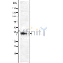 DF8705 staining HeLa by IF/ICC. The sample were fixed with PFA and permeabilized in 0.1% Triton X-100,then blocked in 10% serum for 45 minutes at 25¡ãC. The primary antibody was diluted at 1/200 and incubated with the sample for 1 hour at 37¡ãC. An  Alexa Fluor 594 conjugated goat anti-rabbit IgG (H+L) Ab, diluted at 1/600, was used as the secondary antibod