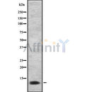 DF8709 staining HepG2 by IF/ICC. The sample were fixed with PFA and permeabilized in 0.1% Triton X-100,then blocked in 10% serum for 45 minutes at 25¡ãC. The primary antibody was diluted at 1/200 and incubated with the sample for 1 hour at 37¡ãC. An  Alexa Fluor 594 conjugated goat anti-rabbit IgG (H+L) Ab, diluted at 1/600, was used as the secondary antibod