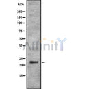 DF8710 staining Hela by IF/ICC. The sample were fixed with PFA and permeabilized in 0.1% Triton X-100,then blocked in 10% serum for 45 minutes at 25¡ãC. The primary antibody was diluted at 1/200 and incubated with the sample for 1 hour at 37¡ãC. An  Alexa Fluor 594 conjugated goat anti-rabbit IgG (H+L) Ab, diluted at 1/600, was used as the secondary antibod