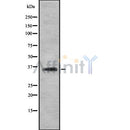 DF8711 staining COLO205 by IF/ICC. The sample were fixed with PFA and permeabilized in 0.1% Triton X-100,then blocked in 10% serum for 45 minutes at 25¡ãC. The primary antibody was diluted at 1/200 and incubated with the sample for 1 hour at 37¡ãC. An  Alexa Fluor 594 conjugated goat anti-rabbit IgG (H+L) Ab, diluted at 1/600, was used as the secondary antibod