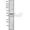DF8712 staining Hela by IF/ICC. The sample were fixed with PFA and permeabilized in 0.1% Triton X-100,then blocked in 10% serum for 45 minutes at 25¡ãC. The primary antibody was diluted at 1/200 and incubated with the sample for 1 hour at 37¡ãC. An  Alexa Fluor 594 conjugated goat anti-rabbit IgG (H+L) Ab, diluted at 1/600, was used as the secondary antibod