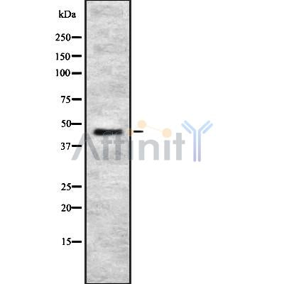 DF8712 staining Hela by IF/ICC. The sample were fixed with PFA and permeabilized in 0.1% Triton X-100,then blocked in 10% serum for 45 minutes at 25¡ãC. The primary antibody was diluted at 1/200 and incubated with the sample for 1 hour at 37¡ãC. An  Alexa Fluor 594 conjugated goat anti-rabbit IgG (H+L) Ab, diluted at 1/600, was used as the secondary antibod