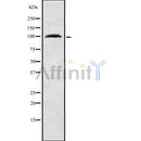 DF8714 staining A549 cells by IF/ICC. The sample were fixed with PFA and permeabilized in 0.1% Triton X-100,then blocked in 10% serum for 45 minutes at 25¡ãC. The primary antibody was diluted at 1/200 and incubated with the sample for 1 hour at 37¡ãC. An  Alexa Fluor 594 conjugated goat anti-rabbit IgG (H+L) antibody(Cat.
