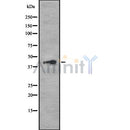 Western blot analysis of extracts from rat brain and mouse spleen, using RPL14 Antibody.