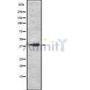 DF8719 staining Hela by IF/ICC. The sample were fixed with PFA and permeabilized in 0.1% Triton X-100,then blocked in 10% serum for 45 minutes at 25¡ãC. The primary antibody was diluted at 1/200 and incubated with the sample for 1 hour at 37¡ãC. An  Alexa Fluor 594 conjugated goat anti-rabbit IgG (H+L) Ab, diluted at 1/600, was used as the secondary antibod