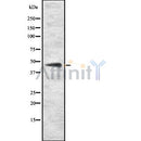 DF8720 staining HepG2 by IF/ICC. The sample were fixed with PFA and permeabilized in 0.1% Triton X-100,then blocked in 10% serum for 45 minutes at 25¡ãC. The primary antibody was diluted at 1/200 and incubated with the sample for 1 hour at 37¡ãC. An  Alexa Fluor 594 conjugated goat anti-rabbit IgG (H+L) Ab, diluted at 1/600, was used as the secondary antibod