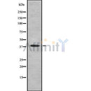DF8723 staining COLO205 by IF/ICC. The sample were fixed with PFA and permeabilized in 0.1% Triton X-100,then blocked in 10% serum for 45 minutes at 25¡ãC. The primary antibody was diluted at 1/200 and incubated with the sample for 1 hour at 37¡ãC. An  Alexa Fluor 594 conjugated goat anti-rabbit IgG (H+L) Ab, diluted at 1/600, was used as the secondary antibod