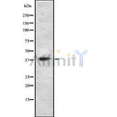 DF8724 staining HuvEc by IF/ICC. The sample were fixed with PFA and permeabilized in 0.1% Triton X-100,then blocked in 10% serum for 45 minutes at 25¡ãC. The primary antibody was diluted at 1/200 and incubated with the sample for 1 hour at 37¡ãC. An  Alexa Fluor 594 conjugated goat anti-rabbit IgG (H+L) Ab, diluted at 1/600, was used as the secondary antibod