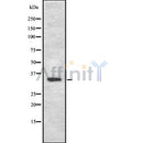 DF8725 staining Hela by IF/ICC. The sample were fixed with PFA and permeabilized in 0.1% Triton X-100,then blocked in 10% serum for 45 minutes at 25¡ãC. The primary antibody was diluted at 1/200 and incubated with the sample for 1 hour at 37¡ãC. An  Alexa Fluor 594 conjugated goat anti-rabbit IgG (H+L) Ab, diluted at 1/600, was used as the secondary antibod