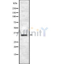 DF8726 staining Hela by IF/ICC. The sample were fixed with PFA and permeabilized in 0.1% Triton X-100,then blocked in 10% serum for 45 minutes at 25¡ãC. The primary antibody was diluted at 1/200 and incubated with the sample for 1 hour at 37¡ãC. An  Alexa Fluor 594 conjugated goat anti-rabbit IgG (H+L) Ab, diluted at 1/600, was used as the secondary antibod