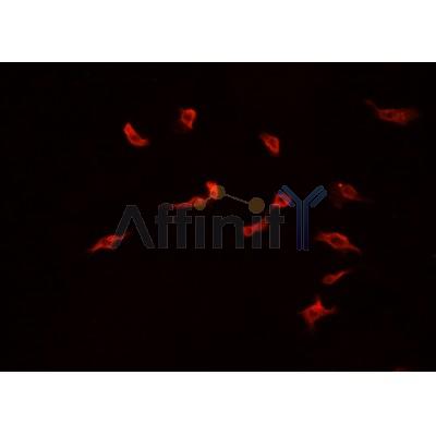AF0187 staining A549? cells by IF/ICC. The sample were fixed with PFA and permeabilized in 0.1% Triton X-100,then blocked in 10% serum for 45 minutes at 25¡ãC. The primary antibody was diluted at 1/200 and incubated with the sample for 1 hour at 37¡ãC. An  Alexa Fluor 594 conjugated goat anti-rabbit IgG (H+L) antibody(Cat.