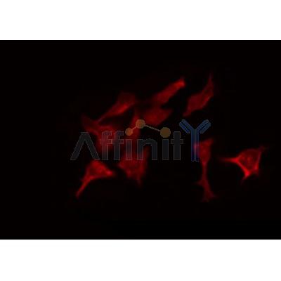 AF0187 staining LOVO by IF/ICC. The sample were fixed with PFA and permeabilized in 0.1% Triton X-100,then blocked in 10% serum for 45 minutes at 25¡ãC. The primary antibody was diluted at 1/200 and incubated with the sample for 1 hour at 37¡ãC. An  Alexa Fluor 594 conjugated goat anti-rabbit IgG (H+L) Ab, diluted at 1/600, was used as the secondary antibod