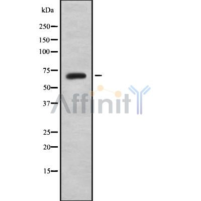 DF8727 staining HepG2 by IF/ICC. The sample were fixed with PFA and permeabilized in 0.1% Triton X-100,then blocked in 10% serum for 45 minutes at 25¡ãC. The primary antibody was diluted at 1/200 and incubated with the sample for 1 hour at 37¡ãC. An  Alexa Fluor 594 conjugated goat anti-rabbit IgG (H+L) Ab, diluted at 1/600, was used as the secondary antibod
