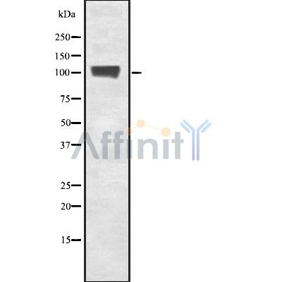 Western blot analysis of extracts from 293, using TF3C3 Antibody. Lane 1 was treated with the blocking peptide.