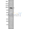 DF8729 staining RAW264.7 by IF/ICC. The sample were fixed with PFA and permeabilized in 0.1% Triton X-100,then blocked in 10% serum for 45 minutes at 25¡ãC. The primary antibody was diluted at 1/200 and incubated with the sample for 1 hour at 37¡ãC. An  Alexa Fluor 594 conjugated goat anti-rabbit IgG (H+L) Ab, diluted at 1/600, was used as the secondary antibod