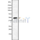 DF8730 at 1/100 staining Mouse colon tissue by IHC-P. The sample was formaldehyde fixed and a heat mediated antigen retrieval step in citrate buffer was performed. The sample was then blocked and incubated with the antibody for 1.5 hours at 22¡ãC. An HRP conjugated goat anti-rabbit antibody was used as the secondary