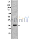 DF8733 staining HepG2 by IF/ICC. The sample were fixed with PFA and permeabilized in 0.1% Triton X-100,then blocked in 10% serum for 45 minutes at 25¡ãC. The primary antibody was diluted at 1/200 and incubated with the sample for 1 hour at 37¡ãC. An  Alexa Fluor 594 conjugated goat anti-rabbit IgG (H+L) Ab, diluted at 1/600, was used as the secondary antibod