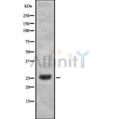 DF8733 staining HepG2 by IF/ICC. The sample were fixed with PFA and permeabilized in 0.1% Triton X-100,then blocked in 10% serum for 45 minutes at 25¡ãC. The primary antibody was diluted at 1/200 and incubated with the sample for 1 hour at 37¡ãC. An  Alexa Fluor 594 conjugated goat anti-rabbit IgG (H+L) Ab, diluted at 1/600, was used as the secondary antibod