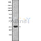 DF8733 staining HepG2 by IF/ICC. The sample were fixed with PFA and permeabilized in 0.1% Triton X-100,then blocked in 10% serum for 45 minutes at 25¡ãC. The primary antibody was diluted at 1/200 and incubated with the sample for 1 hour at 37¡ãC. An  Alexa Fluor 594 conjugated goat anti-rabbit IgG (H+L) Ab, diluted at 1/600, was used as the secondary antibod
