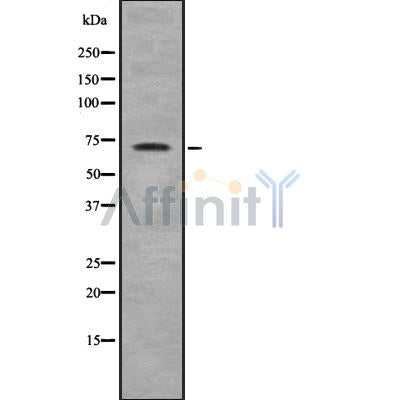 DF8734 staining HepG2 by IF/ICC. The sample were fixed with PFA and permeabilized in 0.1% Triton X-100,then blocked in 10% serum for 45 minutes at 25¡ãC. The primary antibody was diluted at 1/200 and incubated with the sample for 1 hour at 37¡ãC. An  Alexa Fluor 594 conjugated goat anti-rabbit IgG (H+L) Ab, diluted at 1/600, was used as the secondary antibod
