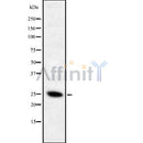 DF8735 staining HepG2 cells by IF/ICC. The sample were fixed with PFA and permeabilized in 0.1% Triton X-100,then blocked in 10% serum for 45 minutes at 25¡ãC. The primary antibody was diluted at 1/200 and incubated with the sample for 1 hour at 37¡ãC. An  Alexa Fluor 594 conjugated goat anti-rabbit IgG (H+L) antibody(Cat.