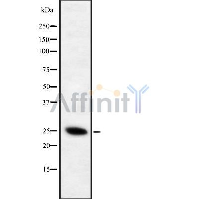 DF8735 staining HepG2 cells by IF/ICC. The sample were fixed with PFA and permeabilized in 0.1% Triton X-100,then blocked in 10% serum for 45 minutes at 25¡ãC. The primary antibody was diluted at 1/200 and incubated with the sample for 1 hour at 37¡ãC. An  Alexa Fluor 594 conjugated goat anti-rabbit IgG (H+L) antibody(Cat.# S0006), diluted at 1/600, was used as secondary antibod