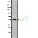 DF8737 at 1/100 staining Human gastric tissue by IHC-P. The sample was formaldehyde fixed and a heat mediated antigen retrieval step in citrate buffer was performed. The sample was then blocked and incubated with the antibody for 1.5 hours at 22¡ãC. An HRP conjugated goat anti-rabbit antibody was used as the secondary