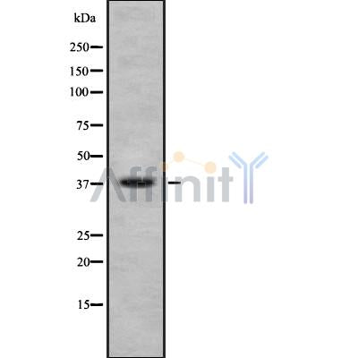 DF8737 at 1/100 staining Human gastric tissue by IHC-P. The sample was formaldehyde fixed and a heat mediated antigen retrieval step in citrate buffer was performed. The sample was then blocked and incubated with the antibody for 1.5 hours at 22¡ãC. An HRP conjugated goat anti-rabbit antibody was used as the secondary