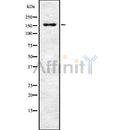 DF8741 at 1/100 staining Human prostate tissue by IHC-P. The sample was formaldehyde fixed and a heat mediated antigen retrieval step in citrate buffer was performed. The sample was then blocked and incubated with the antibody for 1.5 hours at 22¡ãC. An HRP conjugated goat anti-rabbit antibody was used as the secondary