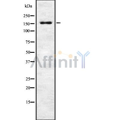 DF8741 at 1/100 staining Human prostate tissue by IHC-P. The sample was formaldehyde fixed and a heat mediated antigen retrieval step in citrate buffer was performed. The sample was then blocked and incubated with the antibody for 1.5 hours at 22¡ãC. An HRP conjugated goat anti-rabbit antibody was used as the secondary