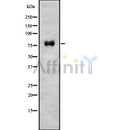 DF8743 staining  HepG2 cells by IF/ICC. The sample were fixed with PFA and permeabilized in 0.1% Triton X-100,then blocked in 10% serum for 45 minutes at 25¡ãC. The primary antibody was diluted at 1/200 and incubated with the sample for 1 hour at 37¡ãC. An  Alexa Fluor 594 conjugated goat anti-rabbit IgG (H+L) antibody(Cat.