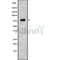 DF8743 staining  HepG2 cells by IF/ICC. The sample were fixed with PFA and permeabilized in 0.1% Triton X-100,then blocked in 10% serum for 45 minutes at 25¡ãC. The primary antibody was diluted at 1/200 and incubated with the sample for 1 hour at 37¡ãC. An  Alexa Fluor 594 conjugated goat anti-rabbit IgG (H+L) antibody(Cat.# S0006), diluted at 1/600, was used as secondary antibod