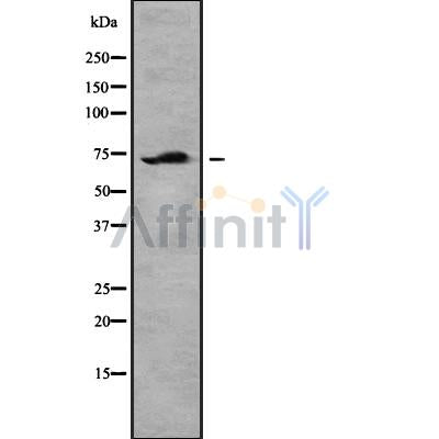 DF8744 at 1/100 staining Mouse lung tissue by IHC-P. The sample was formaldehyde fixed and a heat mediated antigen retrieval step in citrate buffer was performed. The sample was then blocked and incubated with the antibody for 1.5 hours at 22¡ãC. An HRP conjugated goat anti-rabbit antibody was used as the secondary