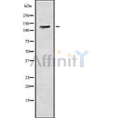 Western blot analysis of ASAP1 using Jurkat whole cell lysates