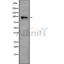 Western blot analysis of TGF ? Receptor III using HepG2 whole cell lysates