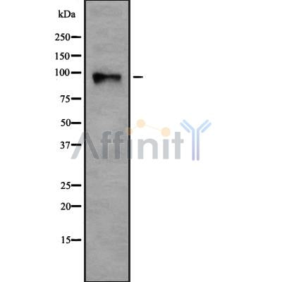 Western blot analysis of TGF ? Receptor III using HepG2 whole cell lysates