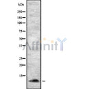 Western blot analysis Sumo2/3/4 using RAW264.7 whole cell lysates