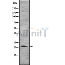 DF8751 at 1/100 staining Mouse liver tissue by IHC-P. The sample was formaldehyde fixed and a heat mediated antigen retrieval step in citrate buffer was performed. The sample was then blocked and incubated with the antibody for 1.5 hours at 22¡ãC. An HRP conjugated goat anti-rabbit antibody was used as the secondary