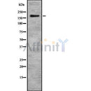 Western blot analysis of CHD1 using MCF7 whole cell lysates