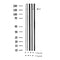 AF3049 staining SK-OV3 by IF/ICC. The sample were fixed with PFA and permeabilized in 0.1% Triton X-100,then blocked in 10% serum for 45 minutes at 25¡ãC. The primary antibody was diluted at 1/200 and incubated with the sample for 1 hour at 37¡ãC. An  Alexa Fluor 594 conjugated goat anti-rabbit IgG (H+L) Ab, diluted at 1/600, was used as the secondary antibod