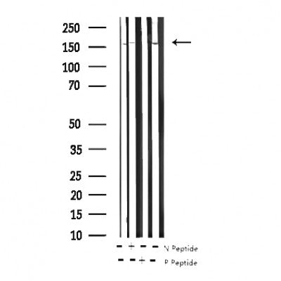 AF3049 staining SK-OV3 by IF/ICC. The sample were fixed with PFA and permeabilized in 0.1% Triton X-100,then blocked in 10% serum for 45 minutes at 25¡ãC. The primary antibody was diluted at 1/200 and incubated with the sample for 1 hour at 37¡ãC. An  Alexa Fluor 594 conjugated goat anti-rabbit IgG (H+L) Ab, diluted at 1/600, was used as the secondary antibod