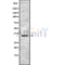 DF8757 staining HepG2 by IF/ICC. The sample were fixed with PFA and permeabilized in 0.1% Triton X-100,then blocked in 10% serum for 45 minutes at 25¡ãC. The primary antibody was diluted at 1/200 and incubated with the sample for 1 hour at 37¡ãC. An  Alexa Fluor 594 conjugated goat anti-rabbit IgG (H+L) Ab, diluted at 1/600, was used as the secondary antibod