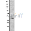DF8762 at 1/100 staining Mouse kidney tissue by IHC-P. The sample was formaldehyde fixed and a heat mediated antigen retrieval step in citrate buffer was performed. The sample was then blocked and incubated with the antibody for 1.5 hours at 22¡ãC. An HRP conjugated goat anti-rabbit antibody was used as the secondary