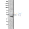 DF8762 at 1/100 staining Mouse kidney tissue by IHC-P. The sample was formaldehyde fixed and a heat mediated antigen retrieval step in citrate buffer was performed. The sample was then blocked and incubated with the antibody for 1.5 hours at 22¡ãC. An HRP conjugated goat anti-rabbit antibody was used as the secondary