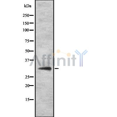 DF8762 at 1/100 staining Mouse kidney tissue by IHC-P. The sample was formaldehyde fixed and a heat mediated antigen retrieval step in citrate buffer was performed. The sample was then blocked and incubated with the antibody for 1.5 hours at 22¡ãC. An HRP conjugated goat anti-rabbit antibody was used as the secondary