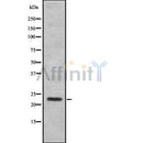 Western blot analysis SAP30 using 293 whole cell lysates