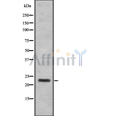 Western blot analysis SAP30 using 293 whole cell lysates